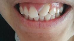 歪牙吃瓜,揭秘娱乐圈的甜蜜与苦涩